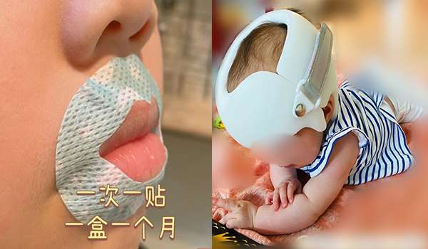 Phụ huynh Trung Quốc thi nhau dán miệng, bó đầu để định hình nhan sắc cho con từ khi mới vài tháng tuổi